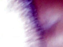 Doctor applies chocolate glaze to patient in hospital.