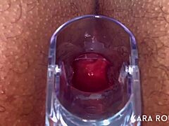 fat hairy bbw mature spreads legs for huge anal speculum gaping