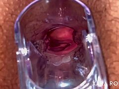 fat hairy bbw mature spreads legs for huge anal speculum gaping