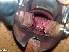 I spread wide for speculum stretching my pussy close up