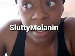 Penile Yeast Infection in Ebony Milf Examined Closely